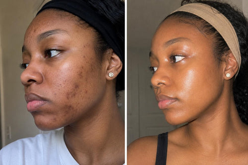 Axis-y Dark Spots Correcting Serum